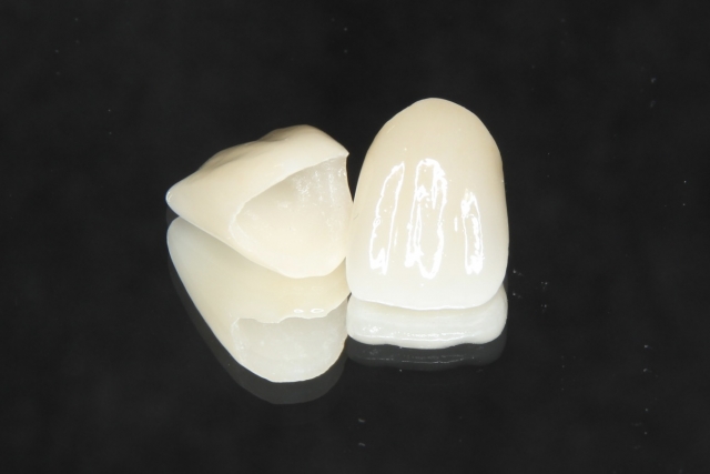 E-MAX（オールセラミック）